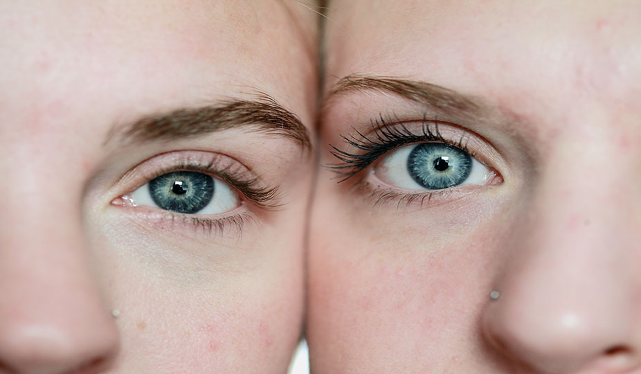Why Are Women Prone More to Eye Health Problems?